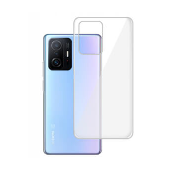 Silikónový obal pre Xiaomi 11T - priehľadný